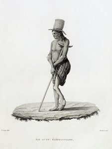 Guam: Een Man met Elephantiasis, uit 